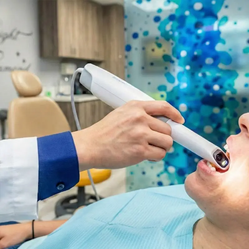 Intraoral digital scanner wand