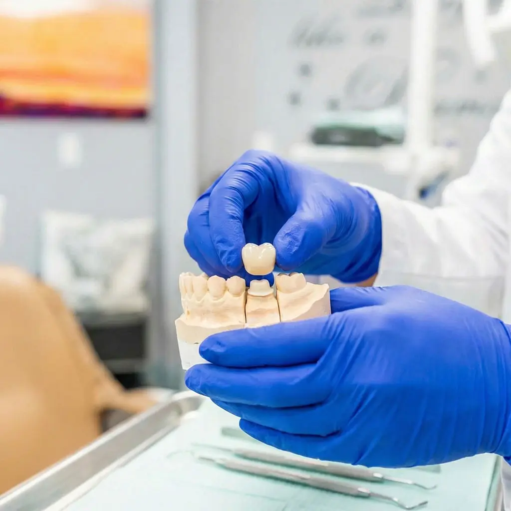 Porcelain crown placement after root canal